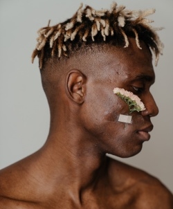 Face of a man with acne marks